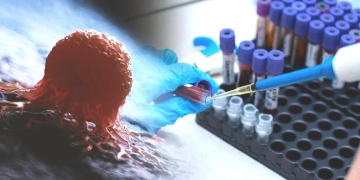 Bilim insanlarından yeni çalışma! Kanser teşhisinde ultra hassas kan testi: Teşhisten 3 yıl öncesine kadar tespit edilebiliyor